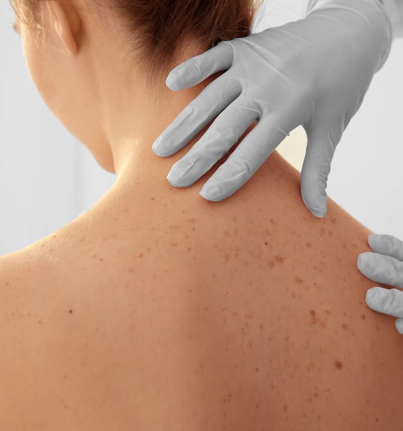 woman having her back examined by dermatologist woman having her back examined by dermatologist